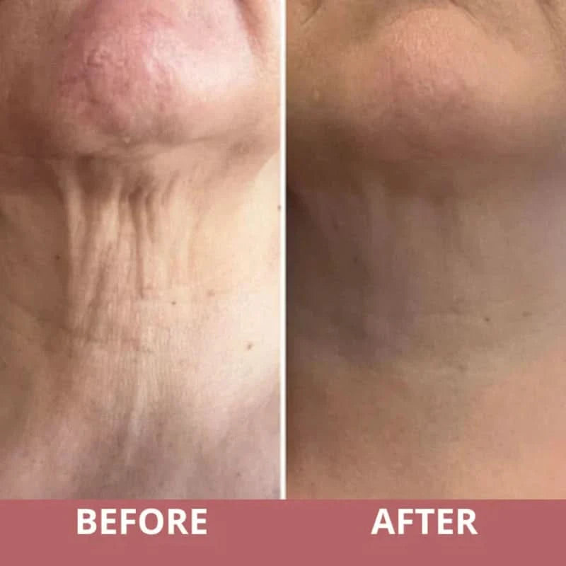 Crema reafirmante para el cuello con masajeador integrado 